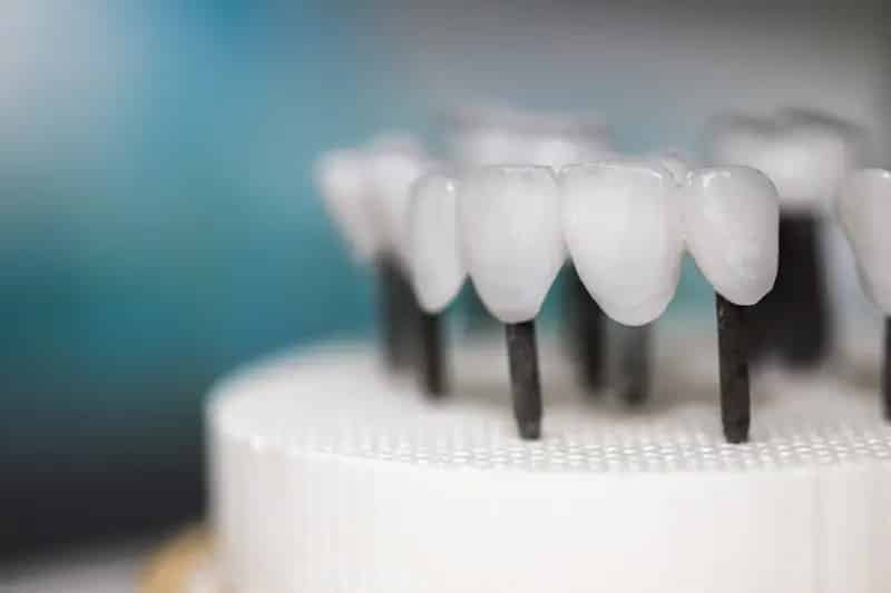 Buy Established Dental Laboratory in Adelaide